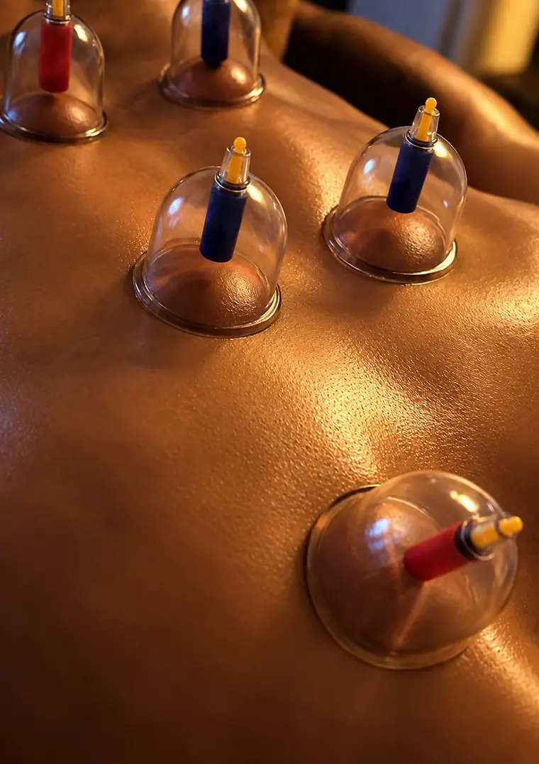 Glass cups on a client's back during a cupping massage.
